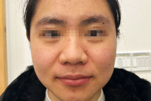 刘女士患有卵巢囊肿中医治愈案例