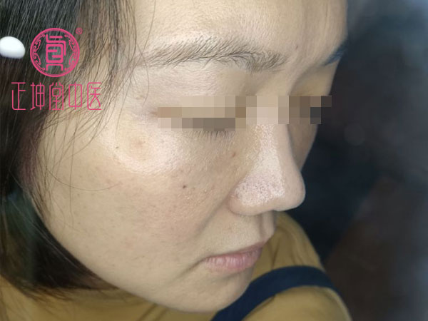 产后皮肤粗糙干燥怎么办