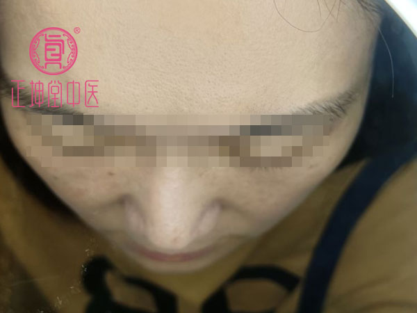产后皮肤粗糙干燥怎么办