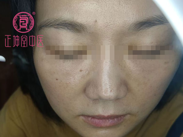 产后皮肤粗糙干燥怎么办
